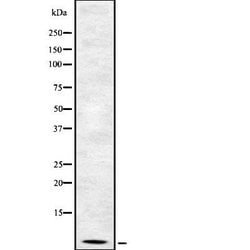 beta-2 Defensin Polyclonal Antibody:Antibodies, Polyclonal