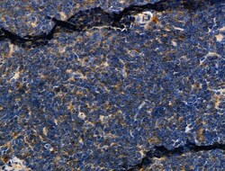 Invitrogen ELMO1 Polyclonal Antibody 100 &mu;L; Unconjugated:Antibodies,