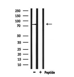Invitrogen SCNN1G Polyclonal Antibody 100 &mu;L; Unconjugated:Antibodies,