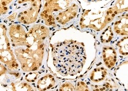 Invitrogen SCNN1G Polyclonal Antibody 100 &mu;L; Unconjugated:Antibodies,