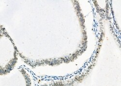 Invitrogen Erbin Polyclonal Antibody 100 &mu;L; Unconjugated:Antibodies,