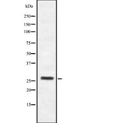 Invitrogen HOXB4 Polyclonal Antibody 100 &mu;L; Unconjugated:Antibodies,
