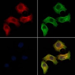 Invitrogen IL20RA Polyclonal Antibody 100 &mu;L; Unconjugated:Antibodies,
