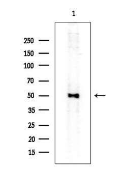 Invitrogen IL20RA Polyclonal Antibody 100 &mu;L; Unconjugated:Antibodies,