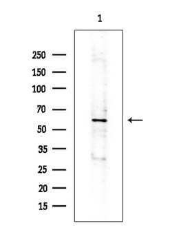 Invitrogen IL20RA Polyclonal Antibody 100 &mu;L; Unconjugated:Antibodies,