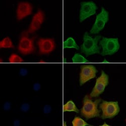Invitrogen IL4R Polyclonal Antibody 100 &mu;L; Unconjugated:Antibodies,