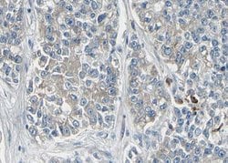 Invitrogen KCNMA1 Polyclonal Antibody 100 &mu;L; Unconjugated:Antibodies,