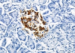 Invitrogen KCNMA1 Polyclonal Antibody 100 &mu;L; Unconjugated:Antibodies,