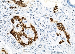 Invitrogen KCNMA1 Polyclonal Antibody 100 &mu;L; Unconjugated:Antibodies,