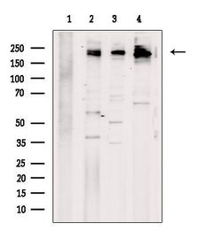 Invitrogen SCN2A Polyclonal Antibody 100 &mu;L; Unconjugated:Antibodies,
