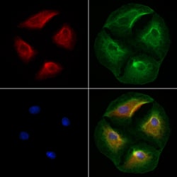 Invitrogen SCN8A Polyclonal Antibody 100 &mu;L; Unconjugated:Antibodies,