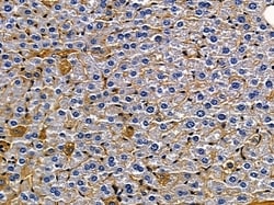 Invitrogen SCN8A Polyclonal Antibody 100 &mu;L; Unconjugated:Antibodies,