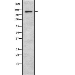 Invitrogen SCN8A Polyclonal Antibody 100 &mu;L; Unconjugated:Antibodies,