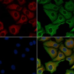 Invitrogen NTN1 Polyclonal Antibody 100 &mu;L; Unconjugated:Antibodies,
