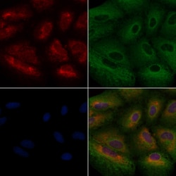 Invitrogen NTN1 Polyclonal Antibody 100 &mu;L; Unconjugated:Antibodies,