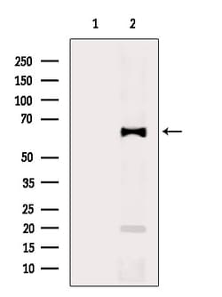 Invitrogen NTN1 Polyclonal Antibody 100 &mu;L; Unconjugated:Antibodies,