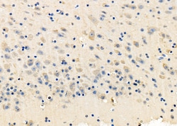 Invitrogen NMDAR2C Polyclonal Antibody 100 &mu;L; Unconjugated:Antibodies,