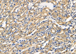 Invitrogen OCRL Polyclonal Antibody 100 &mu;L; Unconjugated:Antibodies,