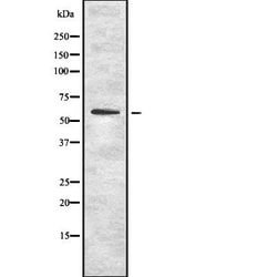 Invitrogen OCT1 Polyclonal Antibody 100 &mu;L | Buy Online | Invitrogen&trade; | Fisher Scientific