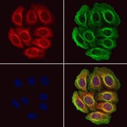 Invitrogen Pepsin A Polyclonal Antibody 100 &mu;L; Unconjugated:Antibodies,