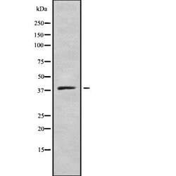 Invitrogen Pepsin A Polyclonal Antibody 100 &mu;L; Unconjugated:Antibodies,