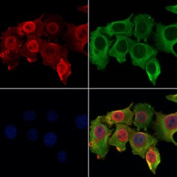 RPA4 Polyclonal Antibody:Antibodies, Polyclonal