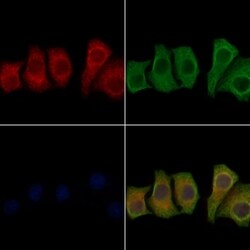 Invitrogen SEC23B Polyclonal Antibody 100 &mu;L; Unconjugated:Antibodies,