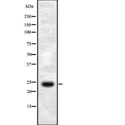 Invitrogen SERTAD1 Polyclonal Antibody 100 &mu;L; Unconjugated:Antibodies,