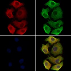 ST3GAL3 Polyclonal Antibody:Antibodies, Polyclonal