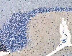 Invitrogen Synphilin 1 Polyclonal Antibody 100 &mu;L; Unconjugated:Antibodies,