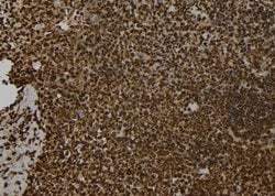 Invitrogen Synphilin 1 Polyclonal Antibody 100 &mu;L; Unconjugated:Antibodies,