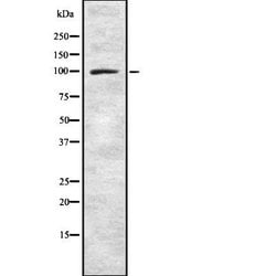 Invitrogen Synphilin 1 Polyclonal Antibody 100 &mu;L; Unconjugated:Antibodies,