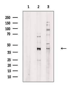 Invitrogen KCNK3 Polyclonal Antibody 100 &mu;L; Unconjugated:Antibodies,