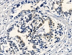 Invitrogen PRSS3 Polyclonal Antibody 100 &mu;L; Unconjugated:Antibodies,