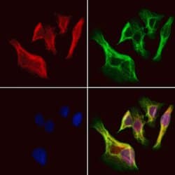 Invitrogen UCP2 Polyclonal Antibody 100 &mu;L; Unconjugated:Antibodies,