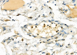 Invitrogen UCP2 Polyclonal Antibody 100 &mu;L; Unconjugated:Antibodies,