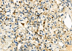 Invitrogen UCP2 Polyclonal Antibody 100 &mu;L; Unconjugated:Antibodies,