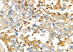 Invitrogen UCP2 Polyclonal Antibody 100 &mu;L; Unconjugated:Antibodies,