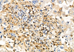 Invitrogen UCP2 Polyclonal Antibody 100 &mu;L; Unconjugated:Antibodies,