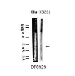 Invitrogen UCP2 Polyclonal Antibody 100 &mu;L; Unconjugated:Antibodies,