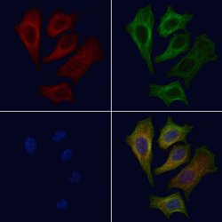 Invitrogen ATP6V0D1 Polyclonal Antibody 100 &mu;L; Unconjugated:Antibodies,