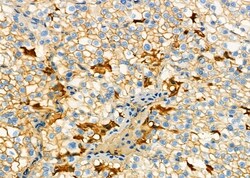 Invitrogen ATP6V0D1 Polyclonal Antibody 100 &mu;L; Unconjugated:Antibodies,