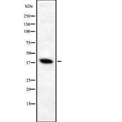 Invitrogen ATP6V0D1 Polyclonal Antibody 100 &mu;L; Unconjugated:Antibodies,