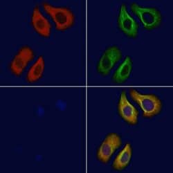 Invitrogen ADORA2B Polyclonal Antibody 100 &mu;L; Unconjugated:Antibodies,