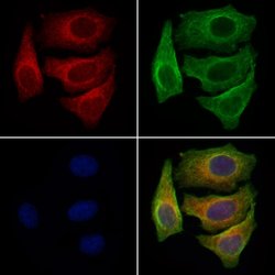 Invitrogen AWAT1 Polyclonal Antibody 100 &mu;L; Unconjugated:Antibodies,