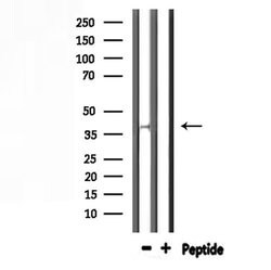 Invitrogen AWAT1 Polyclonal Antibody 100 &mu;L; Unconjugated:Antibodies,