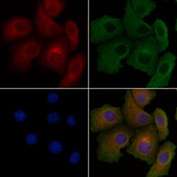 Invitrogen CARD10 Polyclonal Antibody 100 &mu;L; Unconjugated:Antibodies,