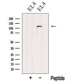 Invitrogen CARD10 Polyclonal Antibody 100 &mu;L; Unconjugated:Antibodies,