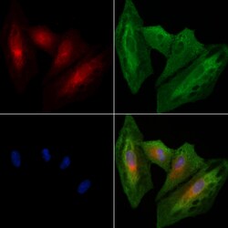 Invitrogen CCRL2 Polyclonal Antibody 100 &mu;L; Unconjugated:Antibodies,