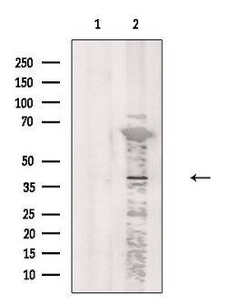 Invitrogen CCRL2 Polyclonal Antibody 100 &mu;L; Unconjugated:Antibodies,